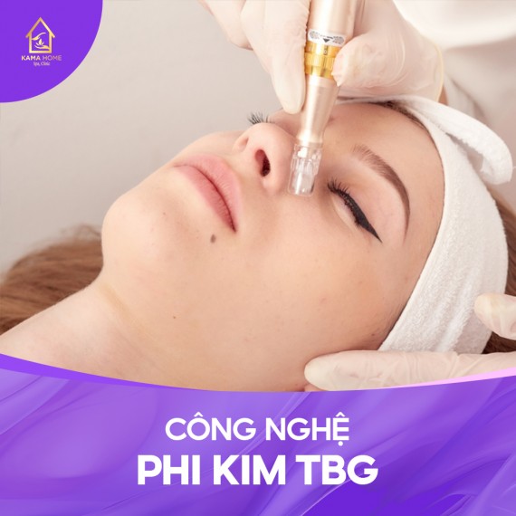 CÔNG NGHỆ PHI KIM TBG