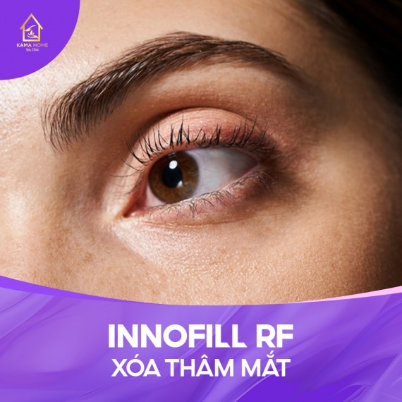 INNOFILL RF XÓA THÂM MẮT