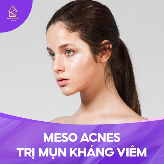 MESO ACNES TRỊ MỤN KHÁNG VIÊM