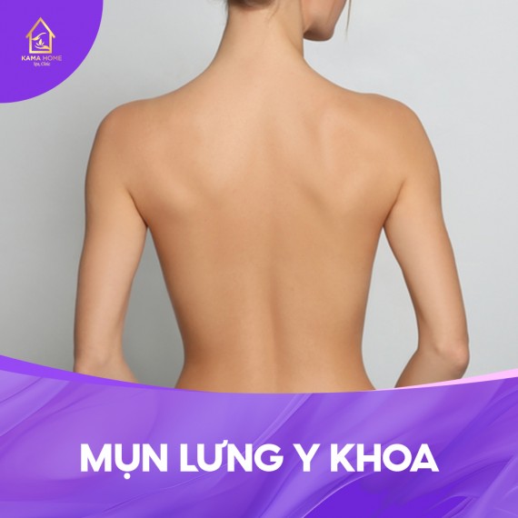 MỤN LƯNG Y KHOA