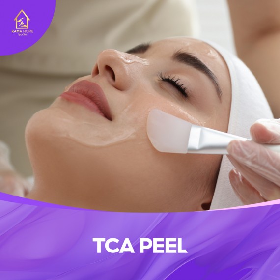 TCA PEEL